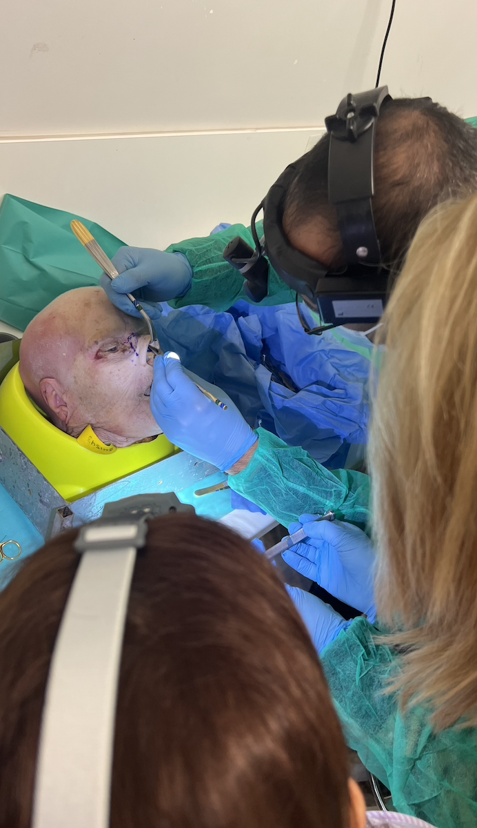 Rhinoplasty cadaver dissection training session during surgical course in Alexandroupolis 2022 educational setting