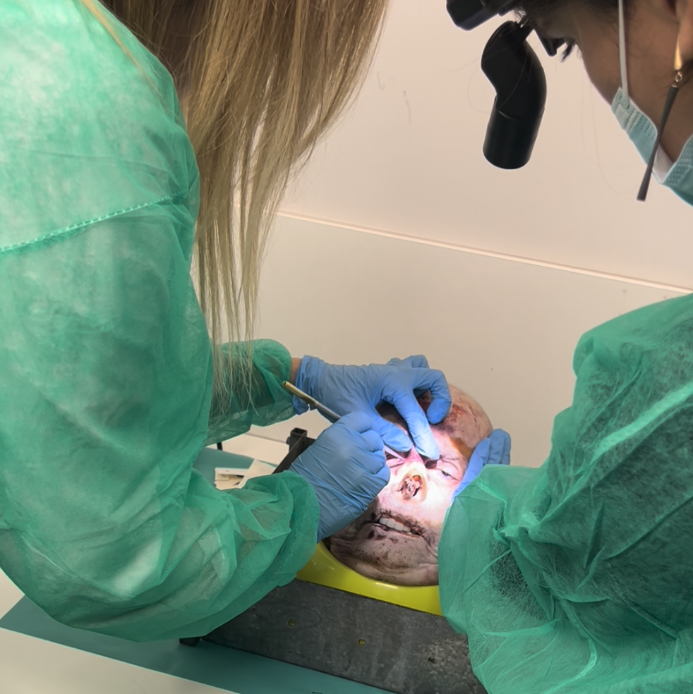Cadaver rhinoplasty dissection training session during Athens Rhinocourse 2017 surgical education setting
