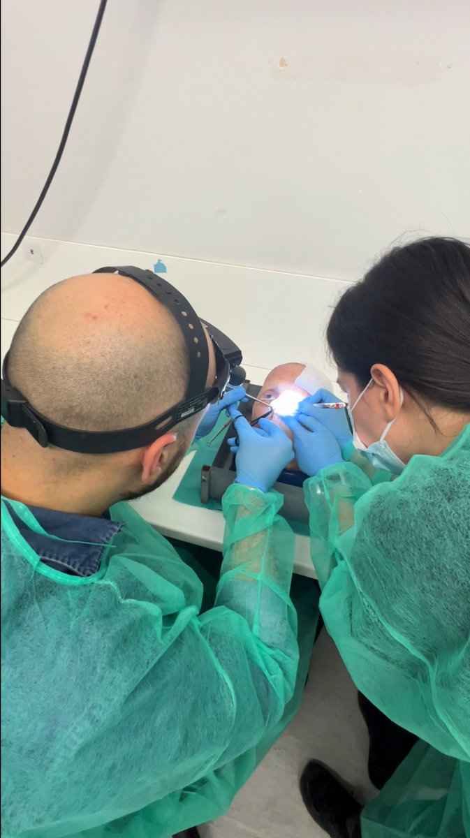 Hands-on rhinoplasty cadaver dissection during HIFPS training course in Athens in 2025