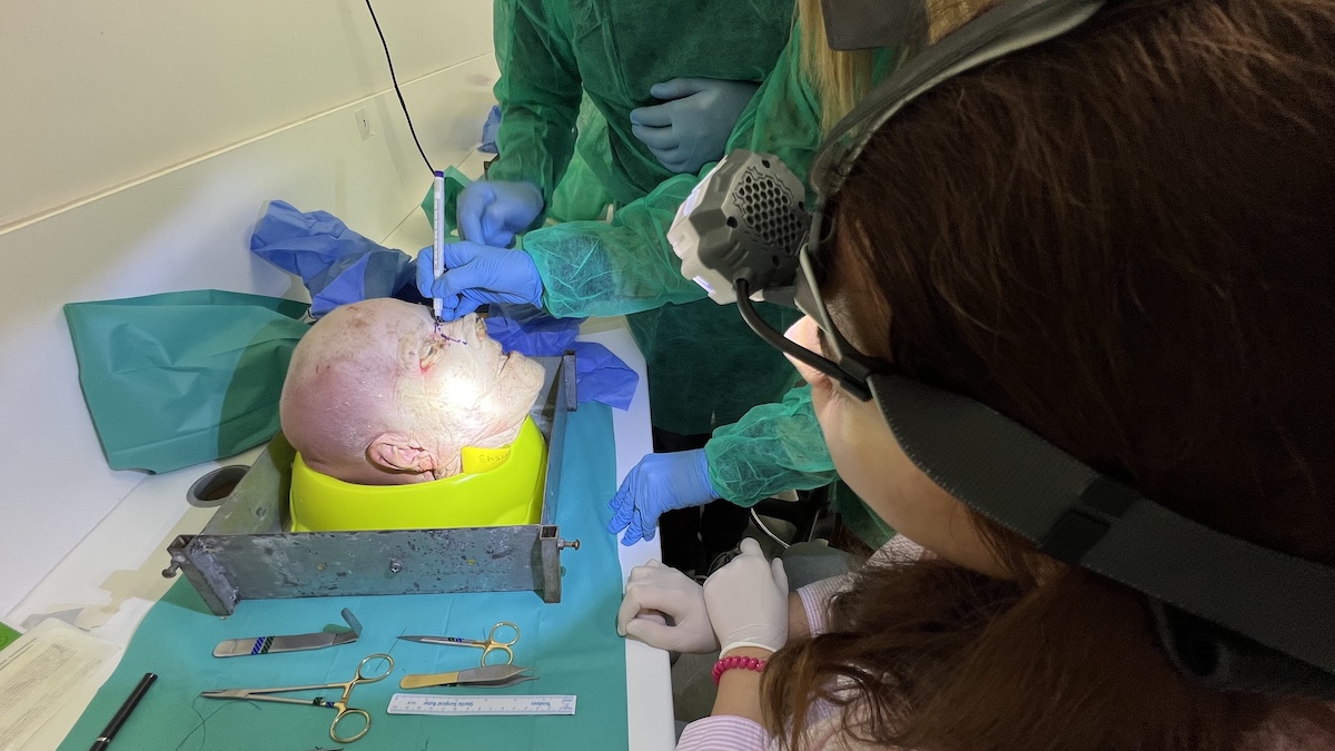 Close-up view of cadaver rhinoplasty surgical dissection during the Athens 2024 course