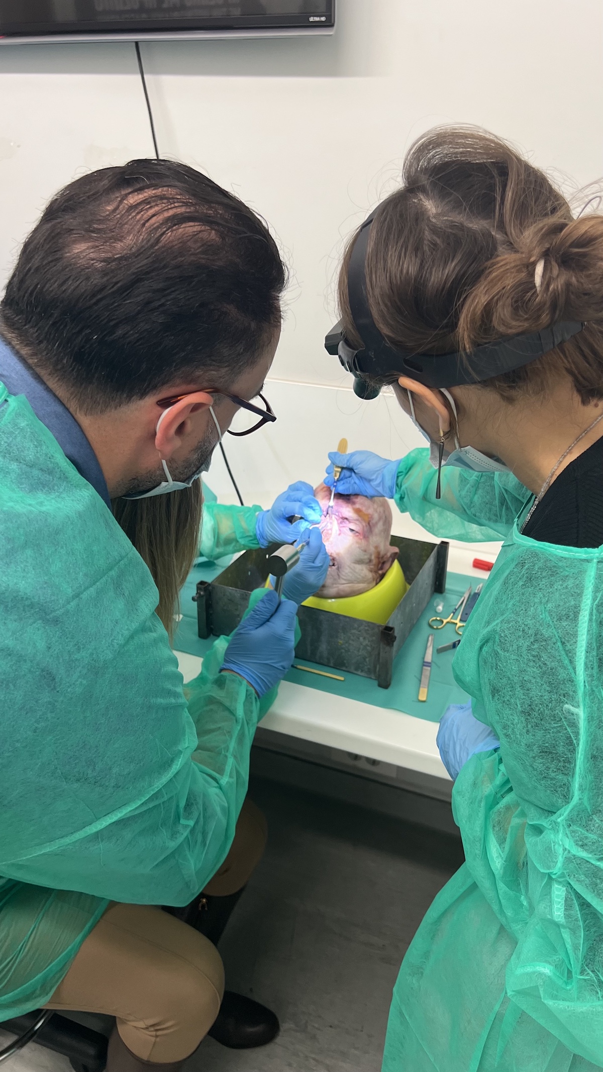 Hands-on cadaver dissection workshop during the Athens 2024 rhinoplasty training course