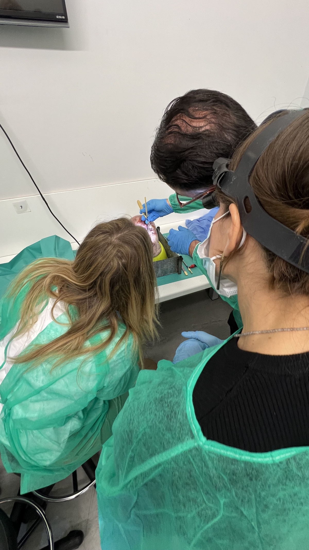 Live rhinoplasty surgical demonstration shown on screen during the Athens 2024 cadaver course