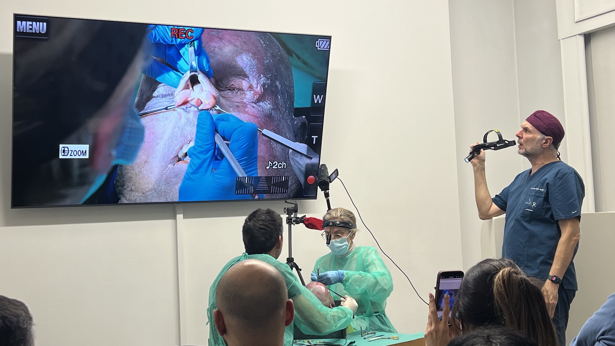 Live rhinoplasty surgery demonstration projected on screen during HIFPS Athens 2025 course