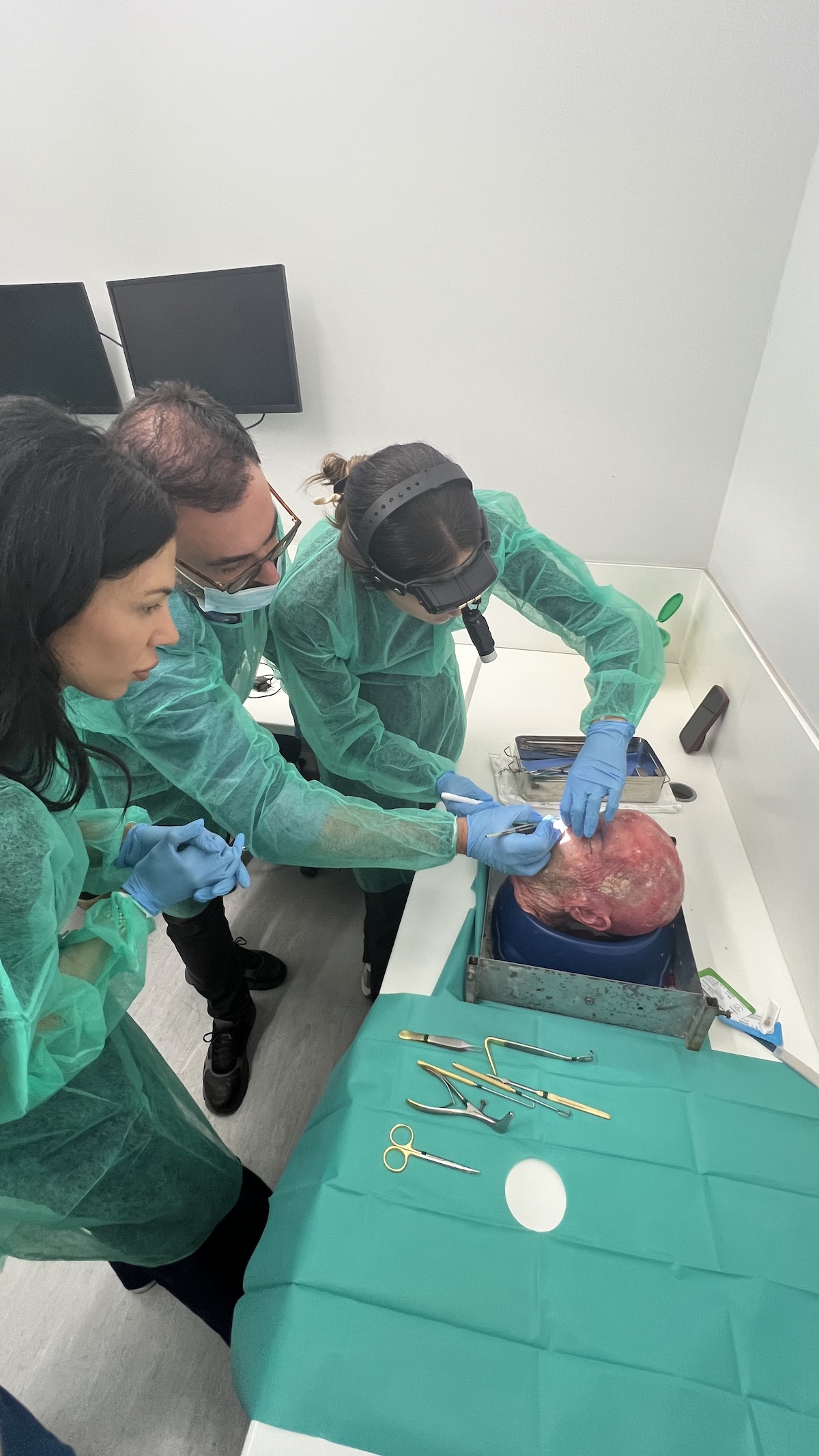 Live rhinoplasty surgical teaching session during HIFPS Athens 2025 course