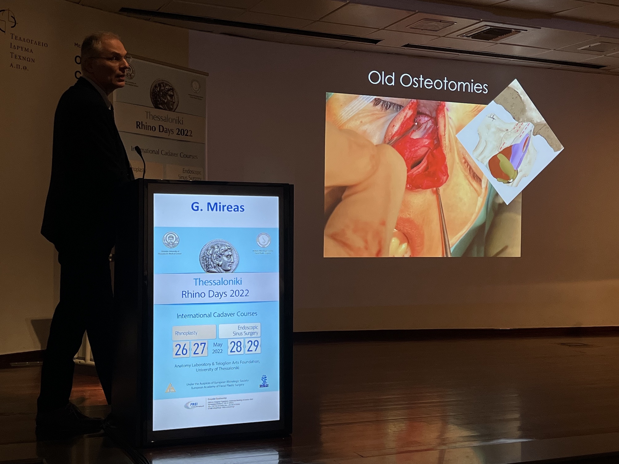Dr George Mireas delivering a rhinoplasty lecture during RhinoDays 2022 in Thessaloniki