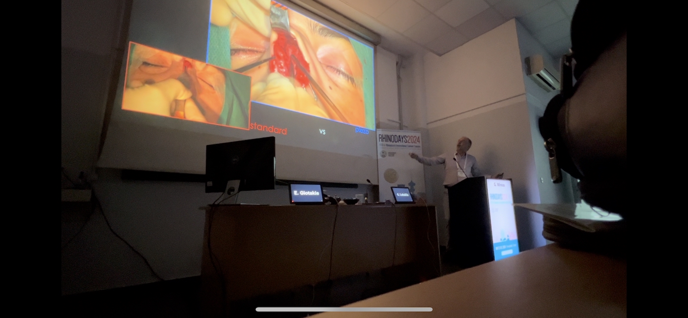 Wide auditorium view of Dr George Mireas presenting during RHINODAYS 2024 in Thessaloniki